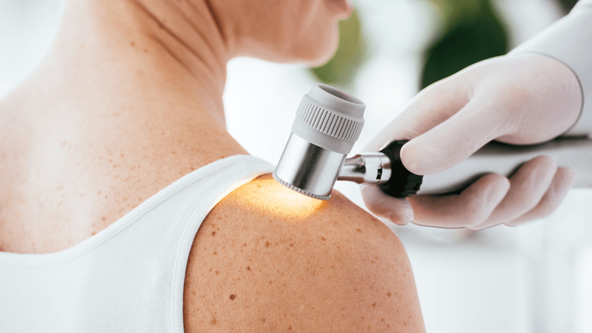 Consultația dermatologică в Бельцах. Дерматолог Бельцы