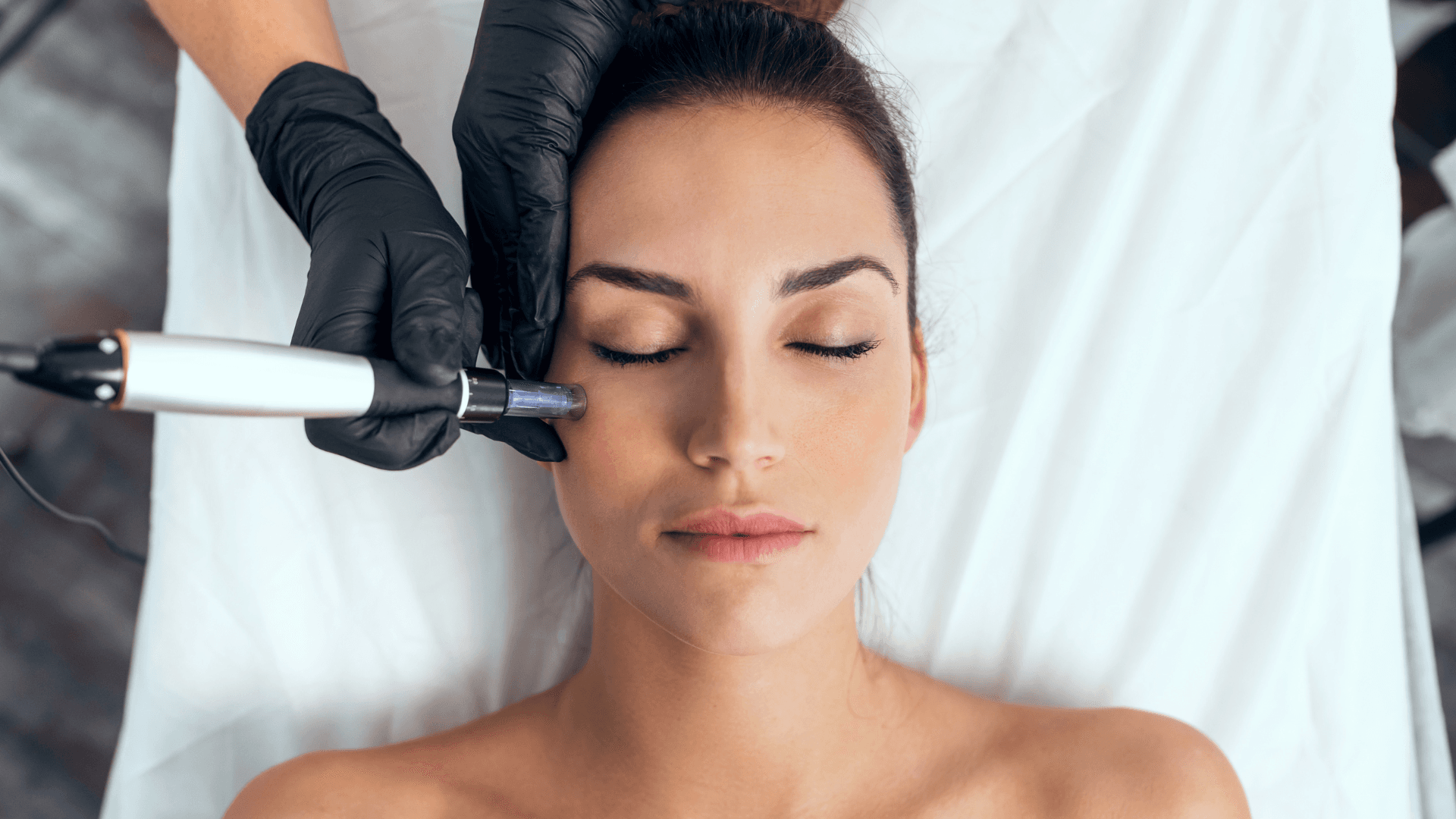 Dermapen в Бельцах. Дерматолог Бельцы