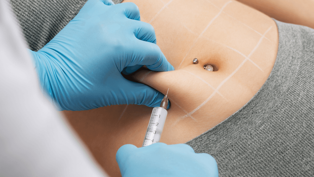 Инъекции липолитиков в Бельцах. Дерматолог Бельцы